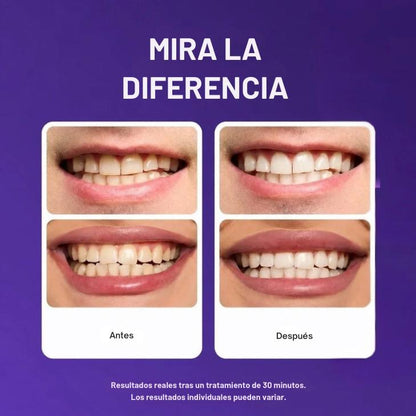 Tiras blanqueadoras de dientes moradas